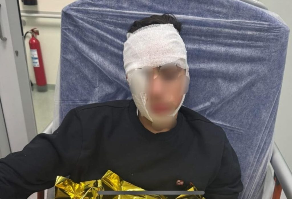 Catania, ragazzo di 14 anni pestato a sangue da una baby gang in Piazza Stesicoro