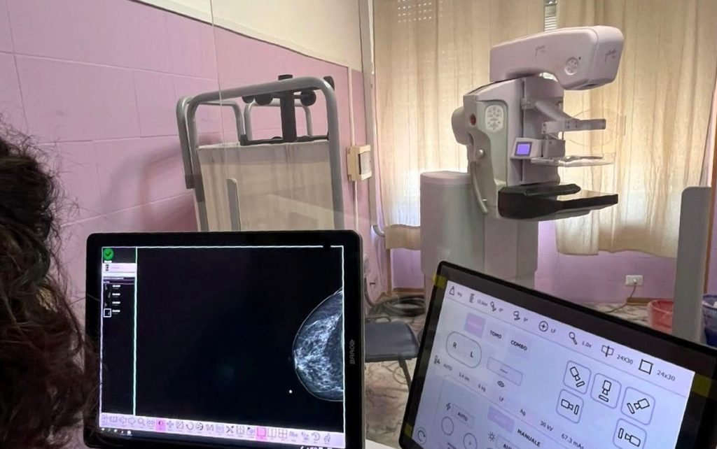 Screening mammografico, l'Asp di Catania apre le porte: sei Open Day a luglio e agosto senza prenotazione